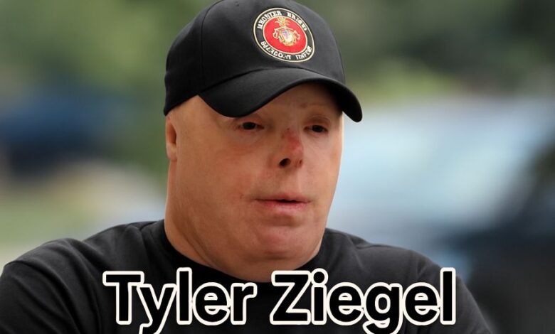 Tyler Ziegel