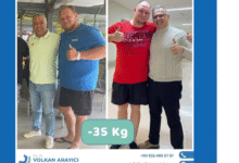 Gastric Sleeve in Turkey