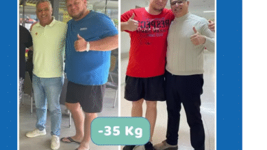 Gastric Sleeve in Turkey