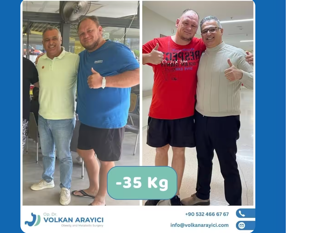 Gastric Sleeve in Turkey: What to Expect Before, During, and After ...